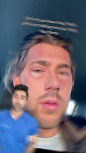 8K views · 115 reactions | Has your hay fever ever been uncontrolled? 蠟 #hayfever #allergies #medical | Kunal Sood, MD | Facebook