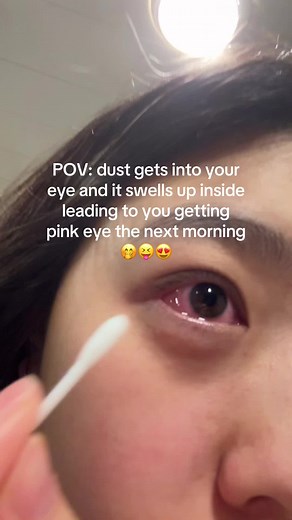 Understanding Pink Eye: Causes and Symptoms