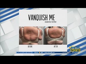 Vanquishing fat with VJazzy Wellness