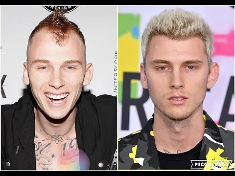 Machine Gun Kelly - Hair Transplant