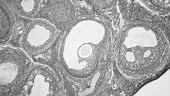 Ovary under the microscope. Microanatomy. Fertility. 100x zoom....