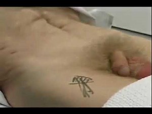 Hernia Examination for Medical Students