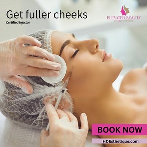 ✨Cheek Augmentation✨ Cheek augmentation is a nonsurgical way to enhance areas of the face. This is a great treatment if you’re looking to contour your face a bit more and smoothen out any fine lines or wrinkles. Cheek fillers provide a bit of a lift and they can also provide volume to the face. Depending on the type of filler used, cheek fillers can last anywhere from 12-14 months. The dermal filler material eventually dissolves and metabolizes into your skin tissue. Contact us today if you have