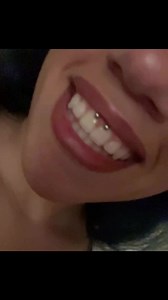 Understanding Smiley Piercings: What You Need to Know
