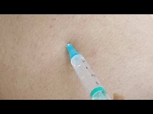 girl getting injection crying painful #intramuscular #Love #Viral #intramuscularinjection #ASMRMASS