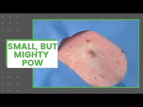 Small, But Mighty POW | Dr. Derm
