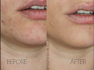 Amazing Cosmetics Concealer Demo + Review