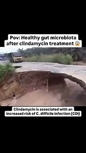 Clindamycin is associated with an increased risk of C. difficile infection (CDI) Clostridioides difficile infection (CDI) is a common cause of health care–associated infections, contributing to excess morbidity, mortality, and health care costs Antibiotics are the greatest risk factor for Clostridioides difficile infection (CDI). Risk for CDI varies across antibiotic types and classes. Optimal prescribing and stewardship recommendations require comparisons of risk across antibiotics. However, ma