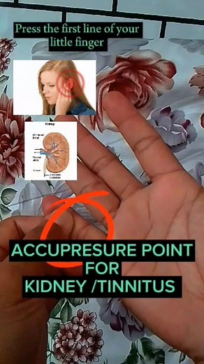 Accupresure point for kidney and tinnitus ( kung nakakaranas kayo ng pag ugong at parang merong tumutunog sa tainga niyo try niyo itong points na to connected po ito sa ating 👂 tainga )#fyp #ochierosemassage #monitizereels #MassageTutorial #reflexology #fypシ゚viral #accupressurepoints #reelsfb @everyone | Ochie&Rose Tv