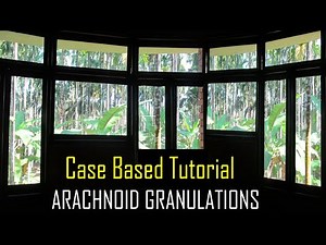 ARACHNOID GRANULATIONS - A CASE BASED TUTORIAL.
