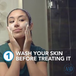 10K views · 84 reactions | Follow these tips for treating deep, painful pimples. If your acne persists, see a board-certified dermatologist for treatment. https://bit.ly/2p2T3Br | American Academy of Dermatology | Facebook