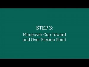 Kiwi® 5-Step Vacuum-Assisted Delivery Technique | Animation Guide