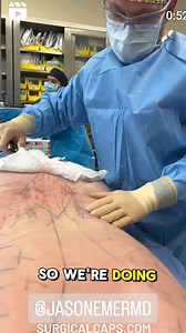 SURGICALCAPS.COM @JasonEmerMD | surgicalcaps.com | Facebook
