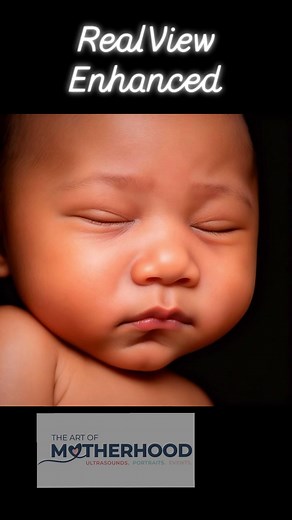 ✨Another beautiful RealView enhanced image! Add a RealView enhancement to your 3D/4Dultrasound package, or choose package 6 and it’s included! www.ArtofMotherhood.com #4DUltrasound #RealView #hinesvillega #poolerga #momtobe #HDUltrasound #3dultrasound #savannahga #ultrasoundstudio #richmondhillga #8k #babyultrasound #babyboutique #richmondhillmoms #3d4dultrasound | Whitney at The Art of Motherhood