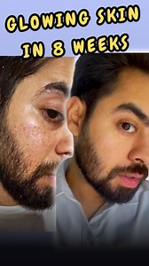 57K views · 18 comments | Looking for CLEAR and GLOWING skin Then...