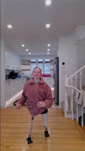 Above-Knee Amputee Girl Walking Naturally with Advanced Prosthetic Legs | Inspiring Transformation
