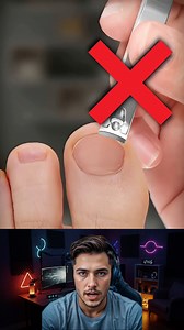 1.4M views · 2.5K reactions | Cut your toenails wrong? Get ready for pain 禮 #trend #viralpost #reelsviralシ | BuzzLook | Facebook