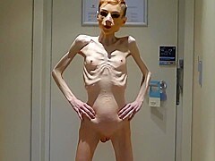 Anorexia Christin showing her Bones & Skinny Skeleton