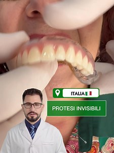 Scopri di più sulle protesi dentarie invisibili | Bright Wave