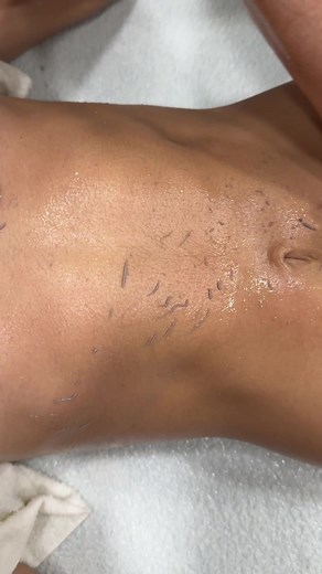 Rejuvenate Your Skin with a Korean Body Scrub at House Of Skyn