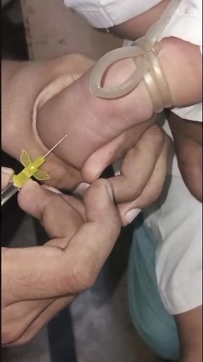 IV cannulation| IV cannula insertion| cannulation technique| IV insertion procedure #ivcannulation