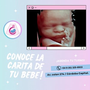 4 comments | Ecografía 5D 殺(semana 25 a 36) - Informe anatómico...