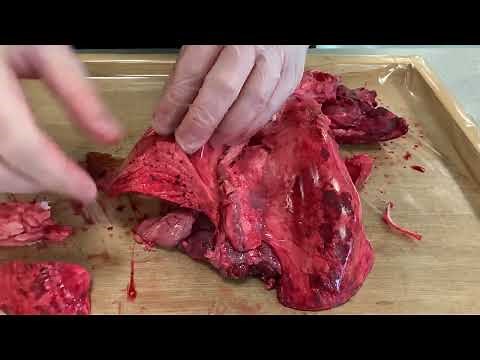 Dissection of lungs