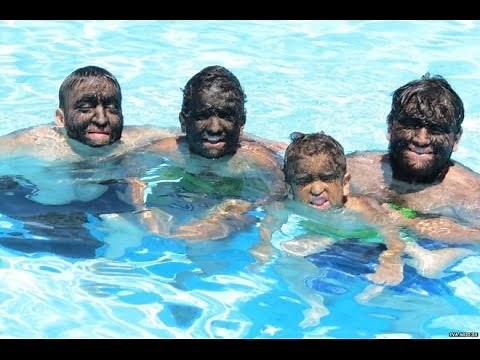 Wolf boy Jesus 'Chuy' Aceves