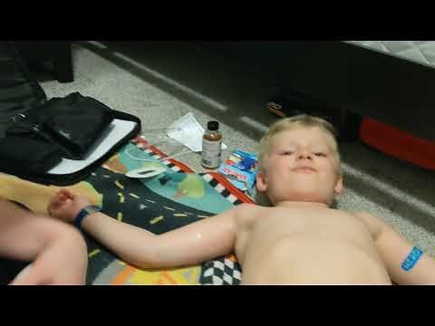 Inserting Dexcom G6 Sensor in Arm of Four Year Old Child with Skin Tac & Overlay Sticker to Stay On