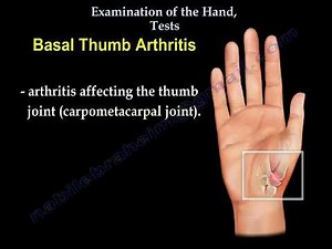 Hand Examination and Carpal Tunnel Syndrome Testing • Video • MEDtube.net