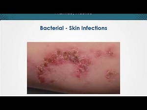Bacterial skin infections | Dermatology | EduRx