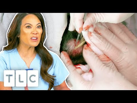 Dr. Lee Gets Splashed With Cyst Juice! | Dr Pimple Popper | UNCENSORED