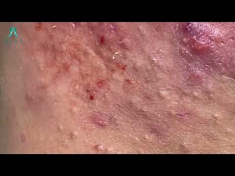 Satisfying Relaxation With Hana Spa #9