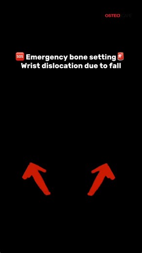 Emergency bone setting: Men dislocated his wrist when trying to support his body during fall 📍SS2 : 3, Jalan SS 2/55, SS 2, 47300 Petaling Jaya, Selangor 📍Bangsar Village II : 3F-3 Bangsar Village II, No 2, Jalan Telawi 1, Bangsar Baru, 59100 Kuala Lumpur 📍Kepong Baru : 18, Prsn Mergastua, Kepong Baru, 52100 KL 📍 Raub : No 30, Lorong Putra Raub 1, Pusat Perniagaan Putra Raub, 27600 Raub, Pahang 📍 Cheras : 37G, Jalan J-avenue, Balakong, 43200 Cheras, Selangor 📍 Rawang : 49-1, Jalan Anggun C