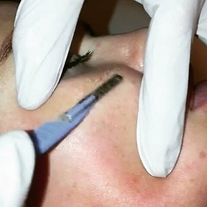 13K views · 19 reactions | Dermaplaning for your life ... ✅Removing dead skin, vellus hair and congestion✖ ✅ smoothing pores✋ ✅giving mega watt GLOW  ✅Improving the overall ' look' of makeup application  ✅ increased absorption of skincare products  #cosmetictreatments #flawlessskin #thatglowthough #skinfetish #skinporn #nonsurgical #procedures #cosmetictherapist #skincare #dermapen #medicalexfoliation #dermaplaning | Flawless Beauty Clinic | Facebook