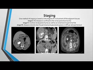 Xanthogranulomatous pyelonephritis