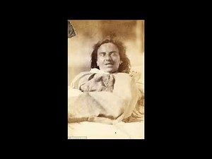 Haunting pictures show female "hysteria" patients in 19th century "asylum"