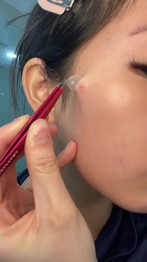 Invisible Pimple Patches Review: Good Molecules