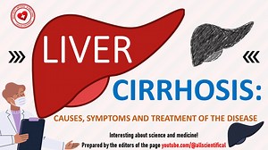 Liver cirrhosis: Causes, symptoms and treatment of the disease Liver...