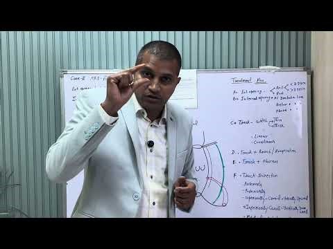 Case - 2 Grade 3 Fistula in Ano #MRI Fistulogram Report Explained | Best Treatment of Fistula