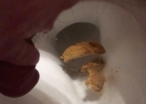 Explosive Fart, Urgent Gassy Logs