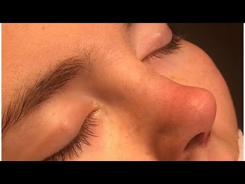 perfect nose in a minute??|DESIRED NOSE SUBLIMINAL