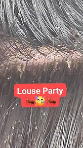 95K views · 275 reactions | Friday Night Louse Party 拾 #RGVLiceLady #headlice #infestation | LRS - Lice Removal Service | Facebook
