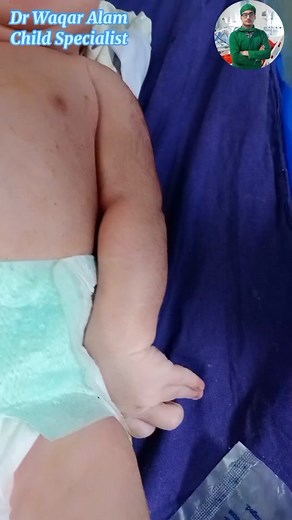 Waiter's Tip Deformity in Babies Erb Palsy #paeds #babies #learnontiktok #learnwithtiktok #childhealth #paedsphysio #growmyaccount #viral #viralvideo #fypシ #500k #foryou #foryoupage #babylove