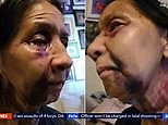 Elderly Mexican woman badly beaten in racially motivated attack