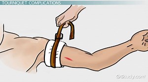 Permanent Damage Caused by Tourniquet | Dangers & Prevention