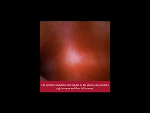 Vaginoscopy with LiNA OperåScope | Procedure Video