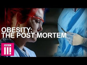 Autopsy On An Obese Woman: Obesity Post-Mortem