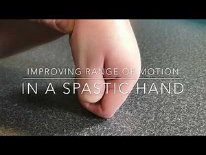 How to address hand spasticity