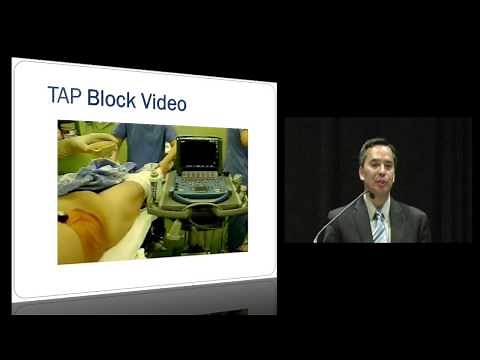 TAP Block for Post Cesarean Delivery Pain